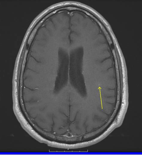 Mr Head With And Without Contrast Greater Waterbury Imaging Center