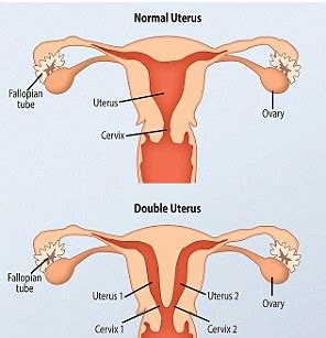 Woman With TWO Vaginas And TWO Cervixes Finally Becomes A Mother After