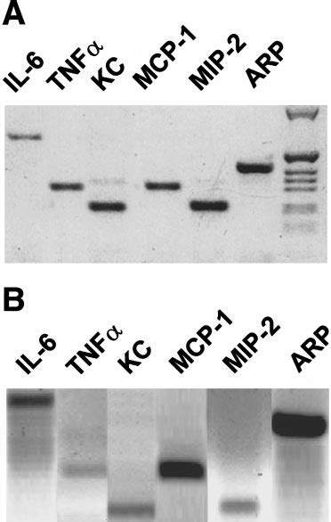 Rat Pancreatic Acinar Cells Express A Variety Of Cytokines And