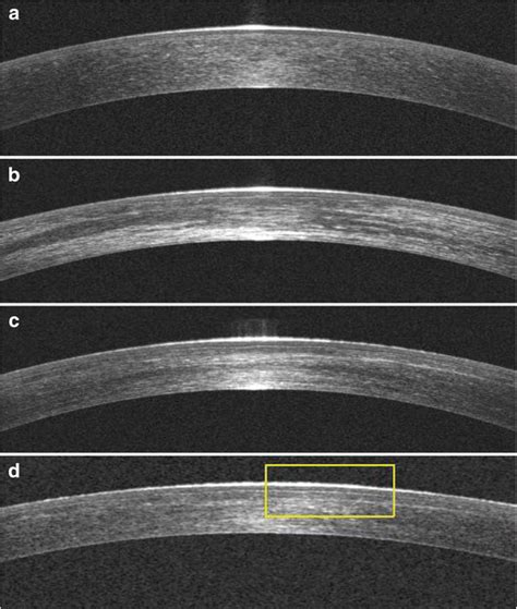 Three Dimensional Optical Coherence Tomography D Oct Images Showing