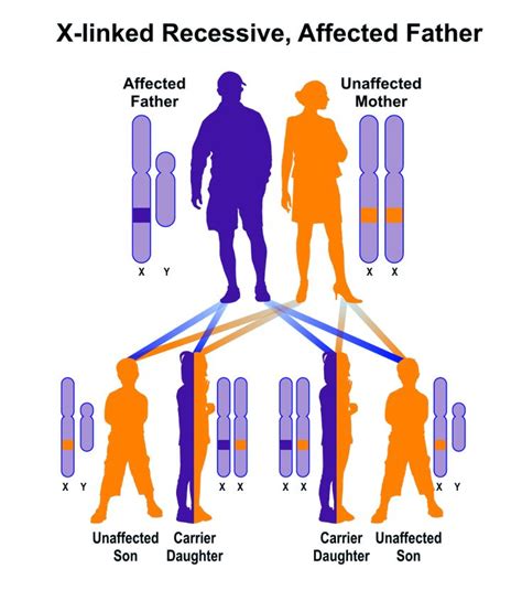 Sample Pedigree Of X Linked Recessive Inheritance Father Affected