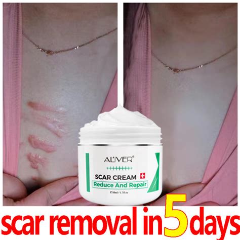 100 Effective Aliver Scar Removal Cream Scar Remover For Old Scar On