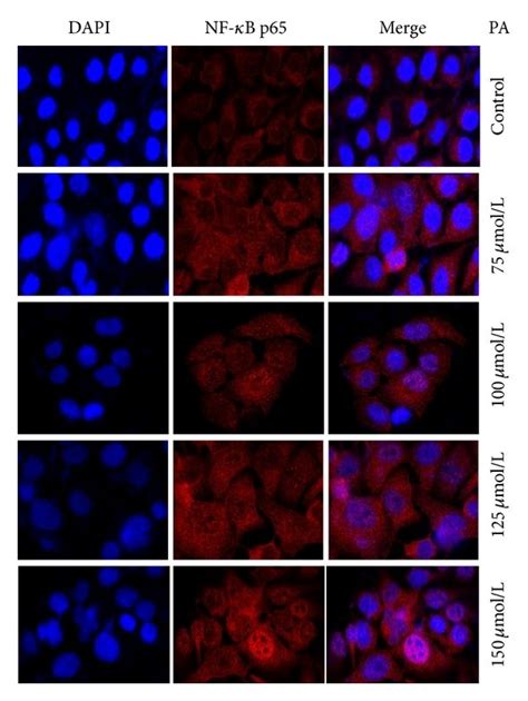 Pa Induced Nuclear Translocation Of Nf B P Subunit In Hacat Cells