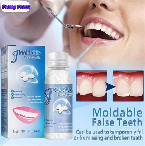 30g Dentures Moldable Temporary Tooth Repair Kit Teeth Gaps Falseteeth