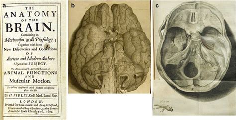 History of Posterior Fossa Tumor Surgery | Neupsy Key