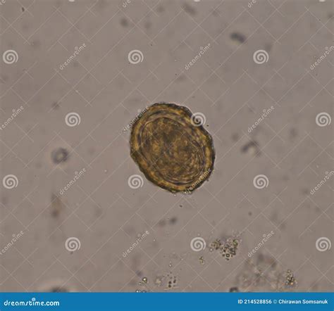 Ascaris Lumbricoides Egg In Stool Exam Stock Photo Image Of Fluke