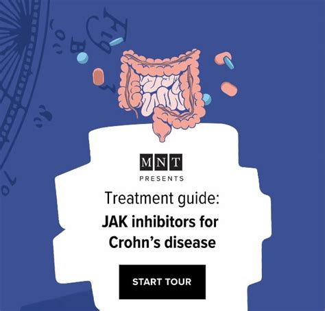 MNT Treatment Guide: JAK Inhibitors for Crohns Disease