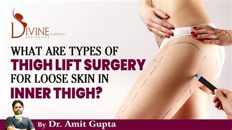 What Are Types Of Thigh Lift Surgery For Loose Skin In Inner Thigh