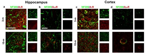 Colocalization Of A1r And A2ar With Neuronal Elements In Hippocampus Download Scientific