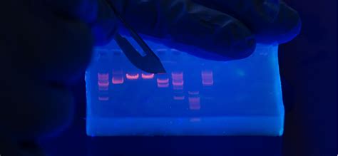 The Electrophoresis Results Best Support Which of the Following