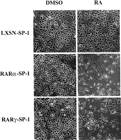 A RAR α and RAR γ transduced SP 1 cell lines overexpress the