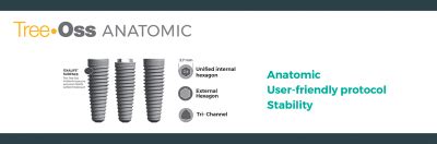 Tree·Oss® ANATOMIC Implant - Tree-Oss | Sistema de implante dental