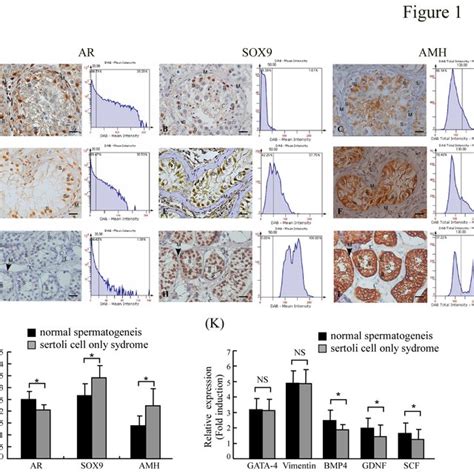 Immunohistochemical analysis of mouse testes. (A) AR, SOX9 and AMH ... 