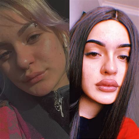 Before And After Imagine How Good Those Lips Feel Nudes Bimbofication NUDE PICS ORG