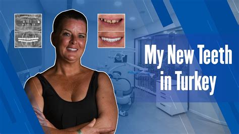 How To Get My New Teeth Done In Turkey Dentares Dental Centre Youtube