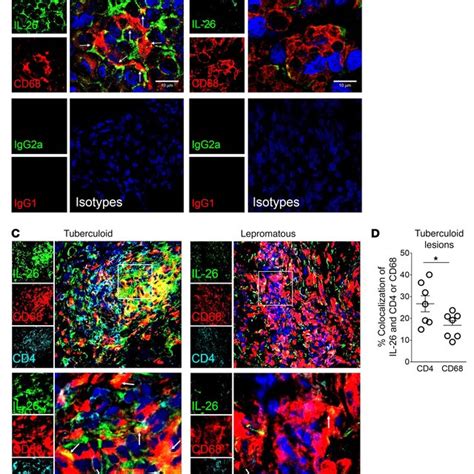 Il 26 Colocalization With Cd68 Macrophages In Leprosy Lesions A Download Scientific