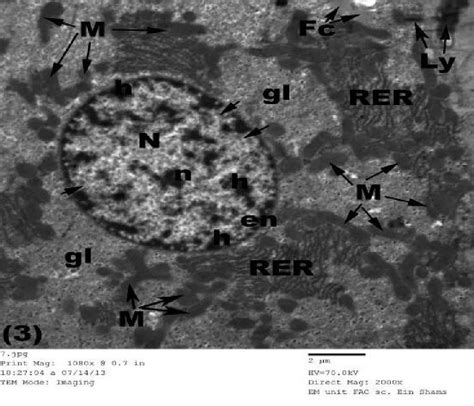 An Electron Micrograph Of A Control Rat S Liver Showing Regular