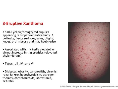 Cutaneous Manifestation Of Systemic Disease By Dr Eman