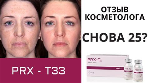 Как делают PRX-T33 пилинг лица. Отзыв врача - YouTube