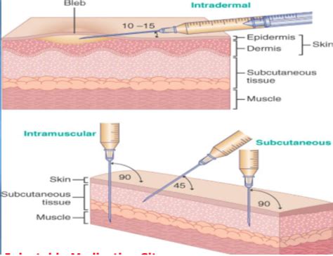 Injectable Medications Subcutaneous Intramuscular Intradermal