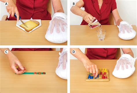 Constraint Induced Movement Therapy After Stroke The Lancet Neurology