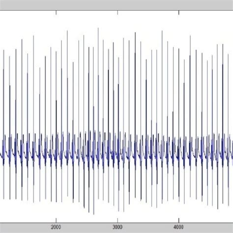 Fpga Based Ecg Signal Processing System Download Scientific Diagram