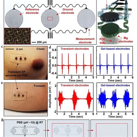 A Optical Image Of The Biodegradable Ep Sensor B Exploded View Of