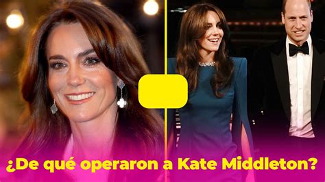 La Delicada Operaci N A La Que Fue Sometida Kate Middleton Cu Nto