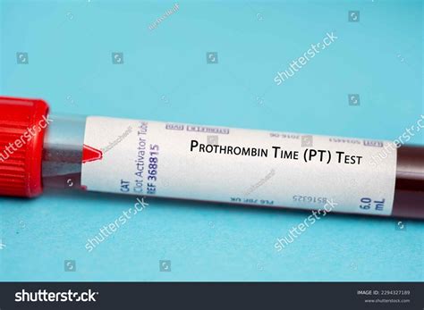 Atividade De Protrombina Abaixo De 70 O Que Significa