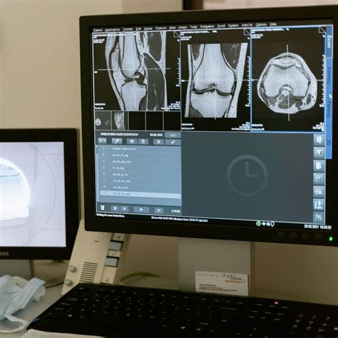 Qué es un Centro de Radiodiagnóstico Clínica Lucena Salud