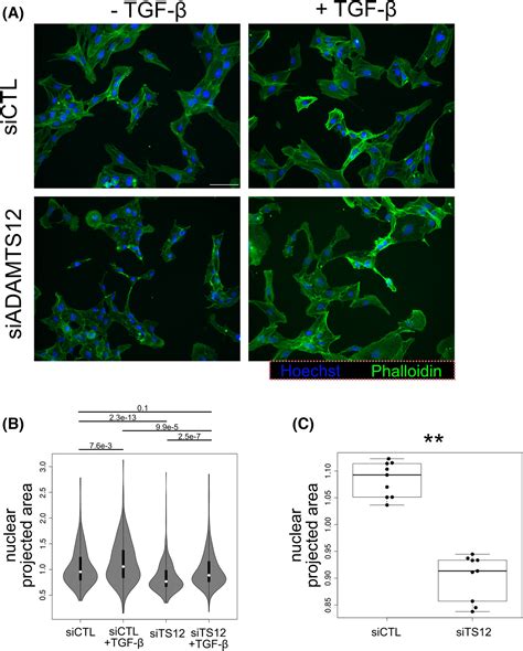 ADAMTS12 Is A Stromal Modulator In Chronic Liver Disease Dekky 2023