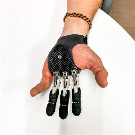 Finger Prostheses All About Function Westcoast Brace And Limb Florida Orthotics And