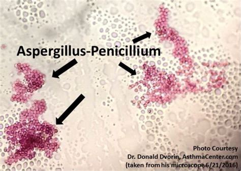 penicillium aspergillus 06 21 2016A | Asthma Center