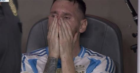 Lionel Messi La Impactante Imagen Del Tobillo De La Pulga Tras Salir