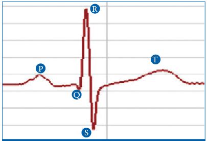 An ECG recording of a heart beat Diagram | Quizlet