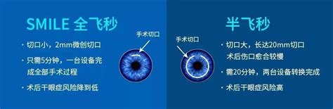 激光近视手术 “全飞秒”vs“半飞秒”