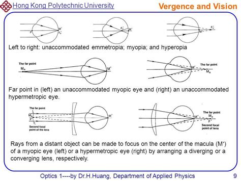 Visualizing the Path of Light in a Myopic Eye