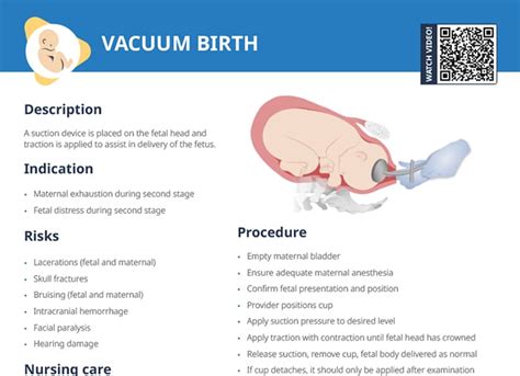 Vacuum Birth Free Cheat Sheet Lecturio Nursing