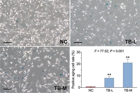 Representative Images Of Sa Gal Staining Of Sk Hep Cells With Tb