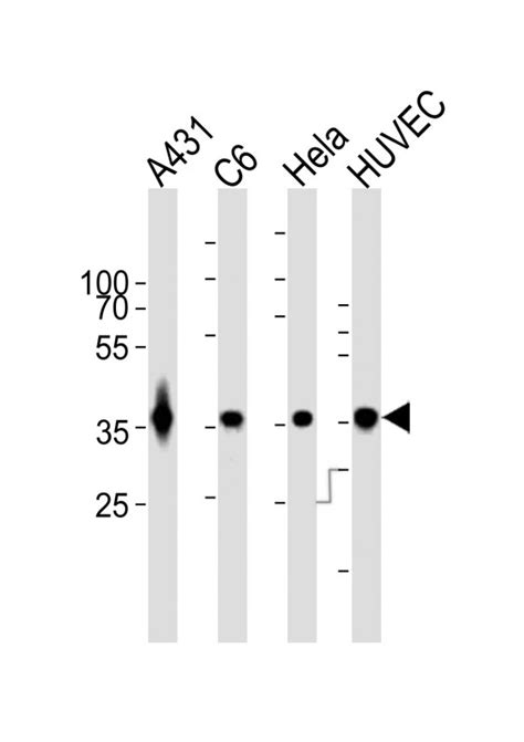 Gapdh Antibody Apr06993g Leading Biology Leading Biology Inc