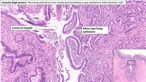 Ampulla – Normal Histology – NUS Pathweb :: NUS Pathweb