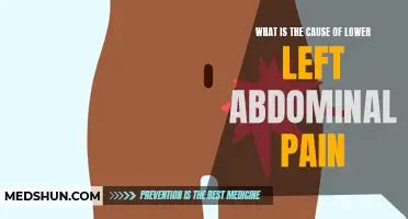 Understanding And Managing Left Lower Abdominal Pain MedShun