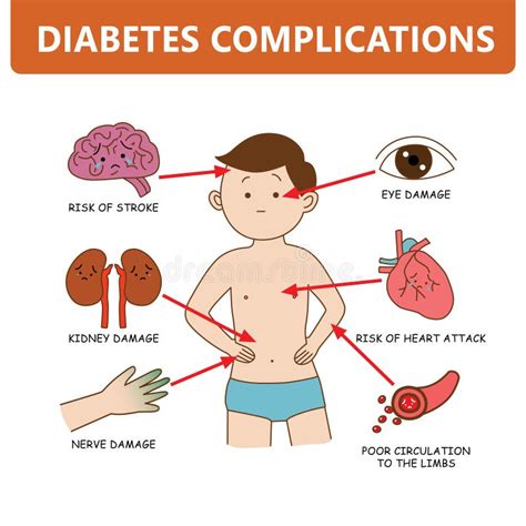 Complicazioni Del Diabete Causate Dall Uomo Sintomo Infografica