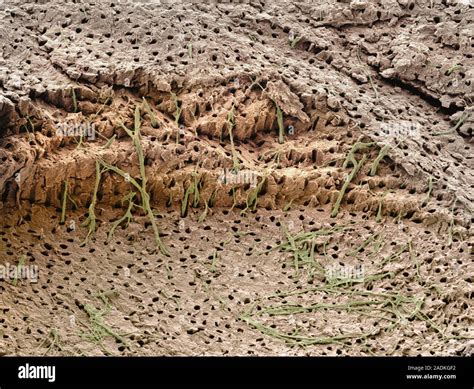 dentin tooth tissue coloured scanning electron micrograph sem