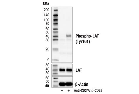 Phospho Lat Tyr E Q R Rabbit Mab Cell Signaling Technology