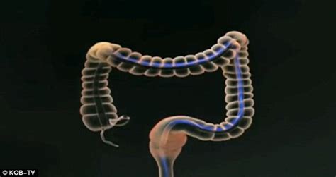 Routine Traffic Stop Results In Hour Anal Cavity Search Including