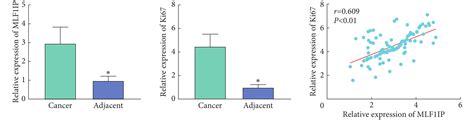 胃癌中mlf1ip表达的预后价值及其对肿瘤进展的调控作用