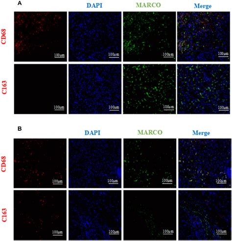 Immunofluorescence Analysis Of Marco Cd63 And Cd163 Expression In Download Scientific Diagram