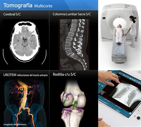 Tomograf A Computarizada Tc Mind Map