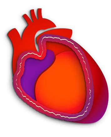 One-Time or Recurrent Pericarditis| What is Pericarditis?